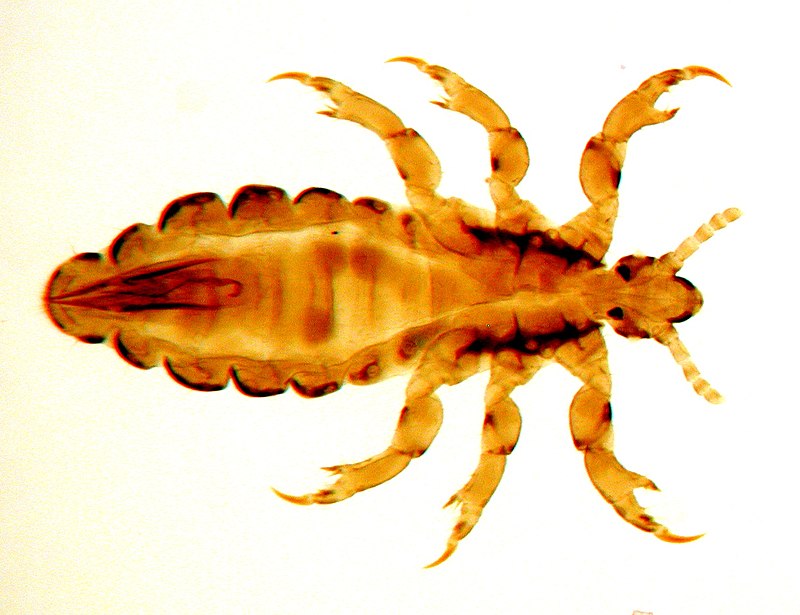 800px-Fig._1._Male_of_head_louse.jpg