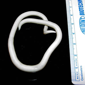 Ascaris_lumbricoides.png